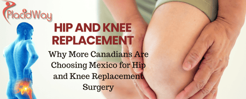 Why More Canadians Are Choosing Mexico for Hip and Knee Replacement Surgery